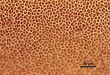 4 - Cellule corticali in visione superficiale